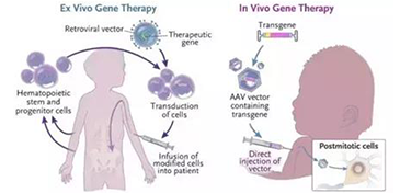 细胞基因治疗
